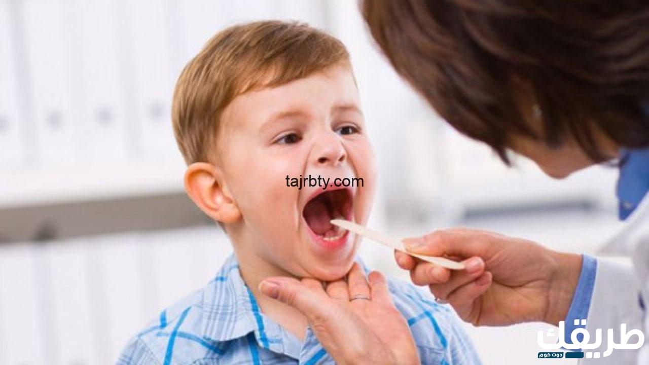 تجربتي في علاج التهاب الحلق عند الاطفال 3 57958641230002